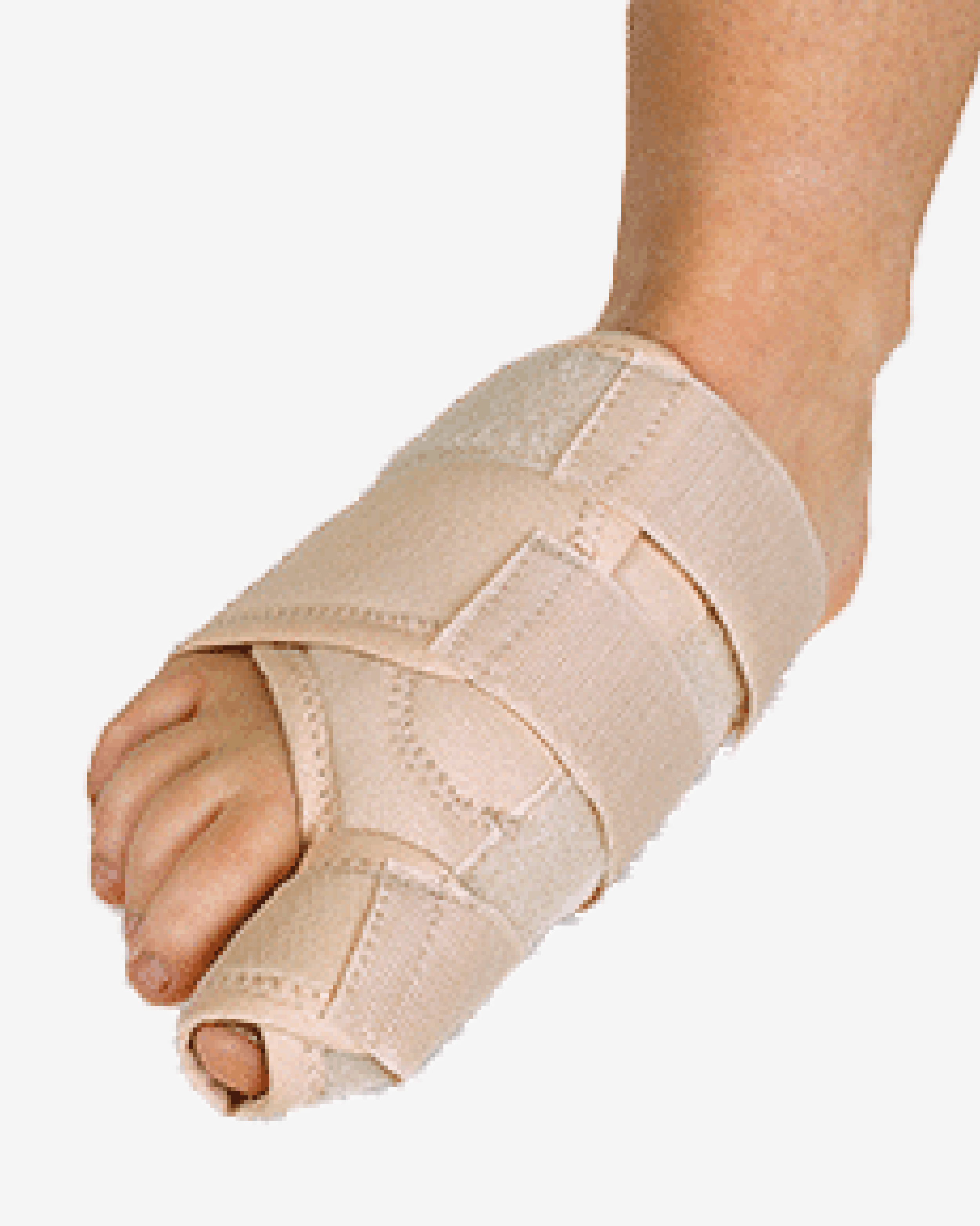 Bunion Correction Resting Splint