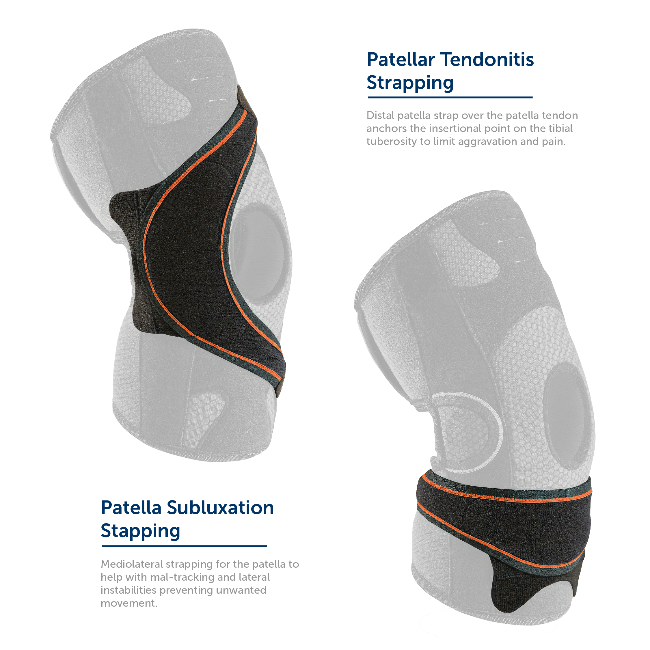 Patella Subluxation & Patellar Tendonitis Attachments