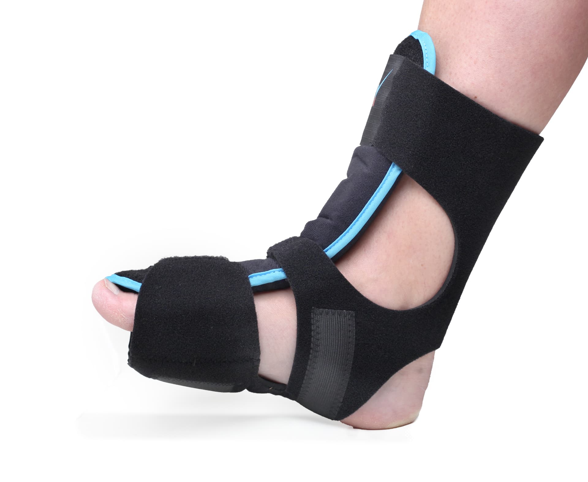 Dorsal Night Splint