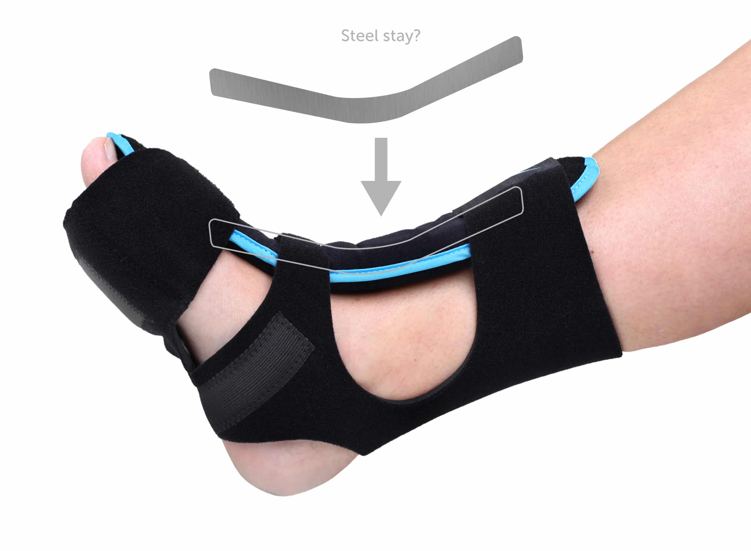 Dorsal Night Splint