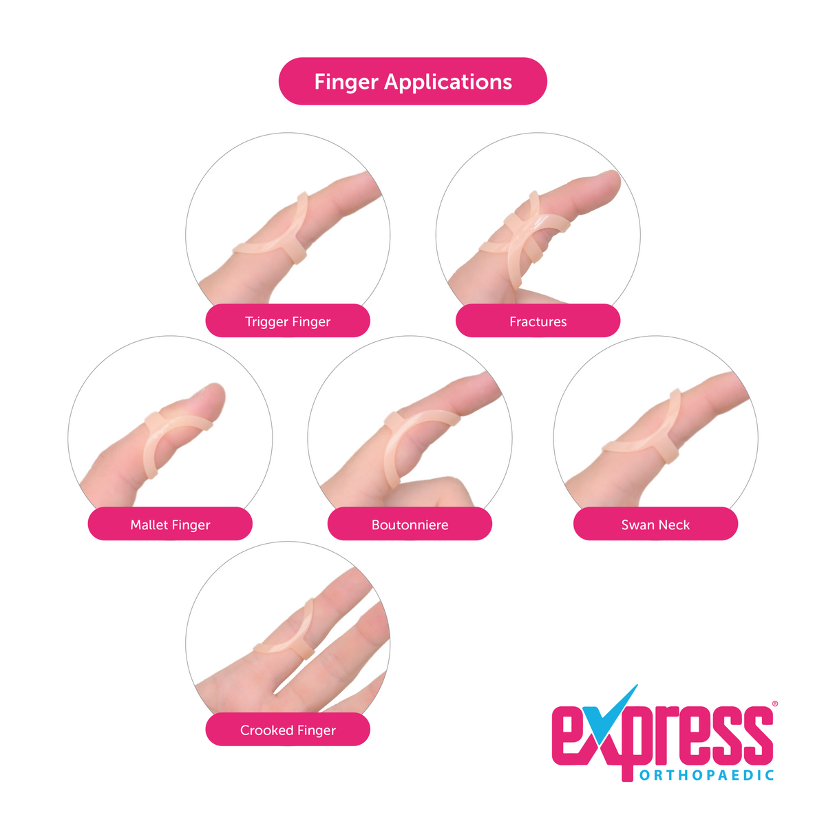 Ring Finger Splint (14-Piece Set) | Orthotix | UK | Orthotix Limited T ...