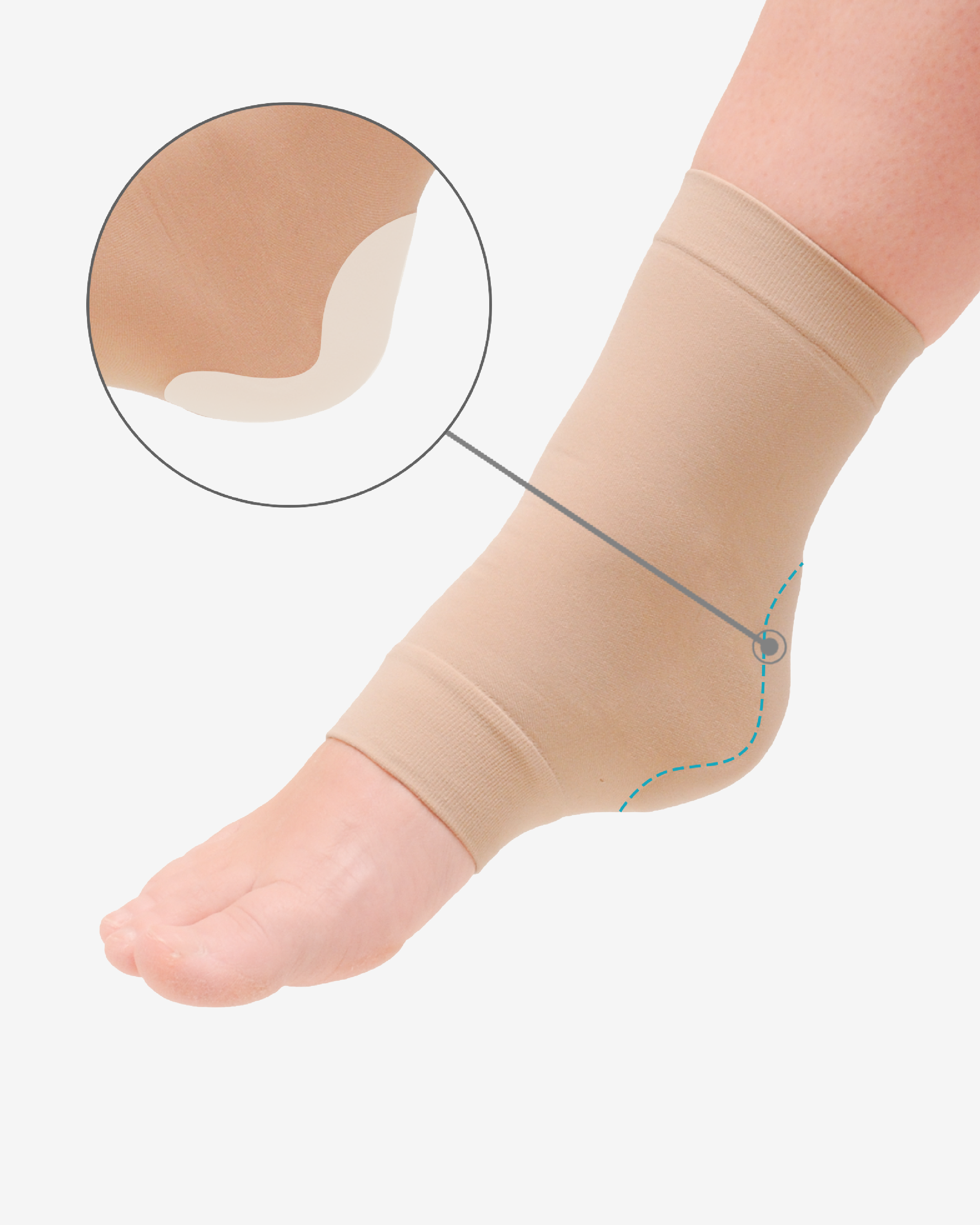 PediGel® Gel Achilles Sleeve (2 Units)